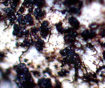 Black Pit Lichen, VERRUCARIA NIGRESCENS, microscopic view