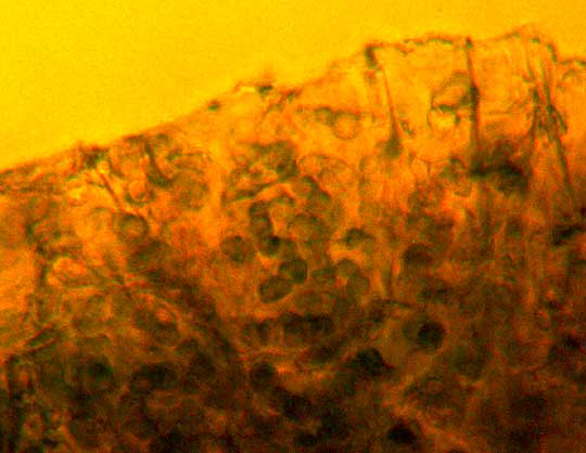 Microscopic Nostoc cells in jelly Lichen, COLLEMA cf. POLYCARPON