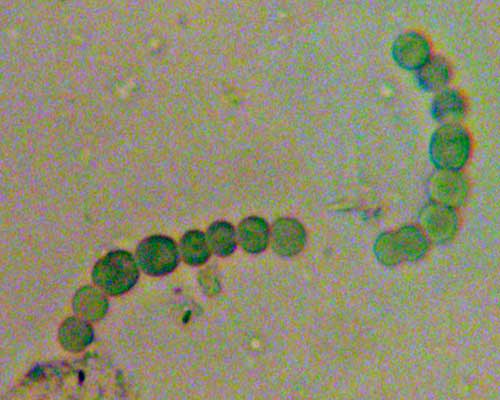Nostoc cells teased from Jelly Lichen, Collema